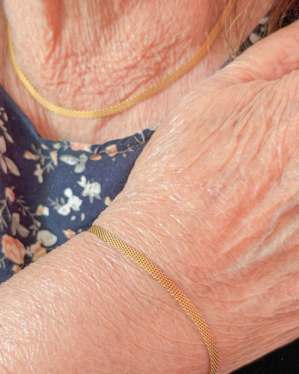 ست حصیری – استیل ضد حساسیت