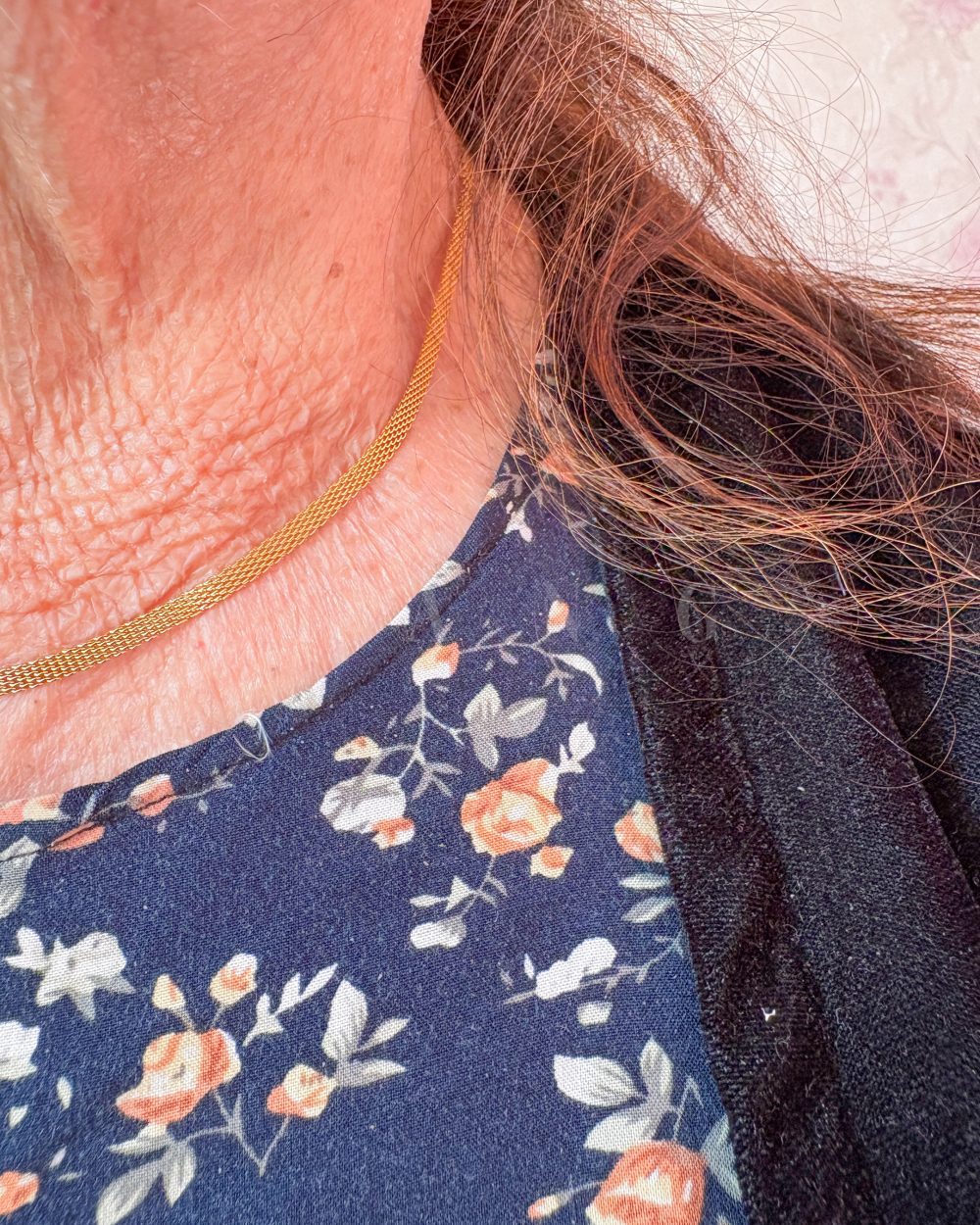 ست حصیری – استیل ضد حساسیت